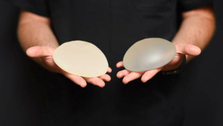 Vergrößerung der Brustgröße und -form mit Implantaten